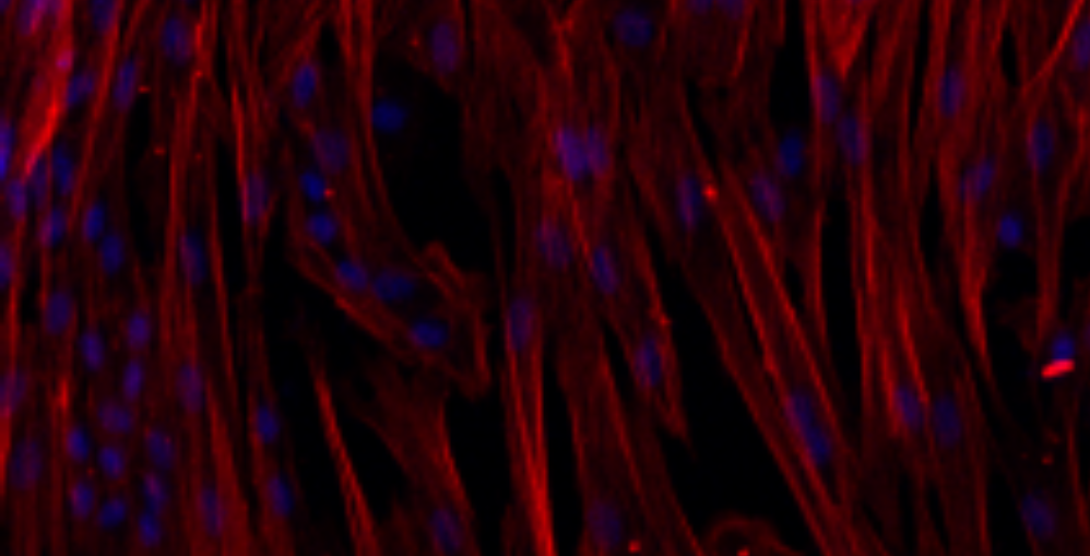 The Mastermind Behind Liver Fibrosis Revealed! Tame This Troublemaker for Flawless Experiments!​​