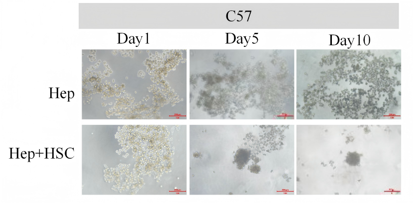 3D Spheroids for Hepatic Fibrosis Model(图1)