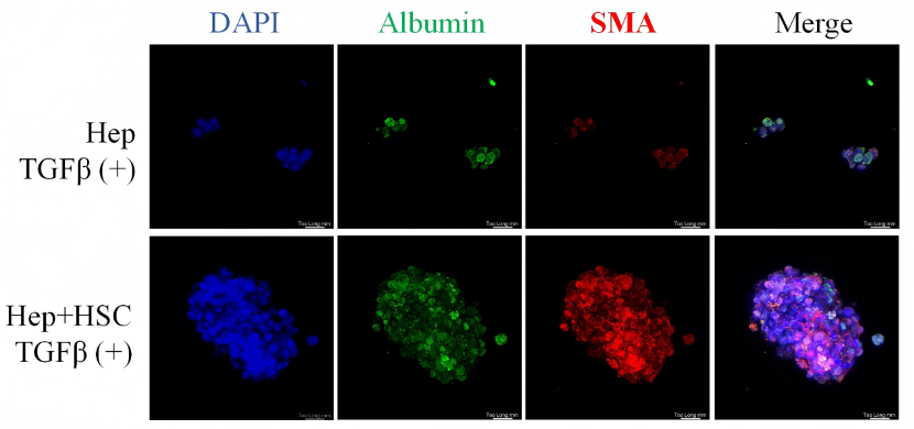 3D Spheroids for Hepatic Fibrosis Model(图2)