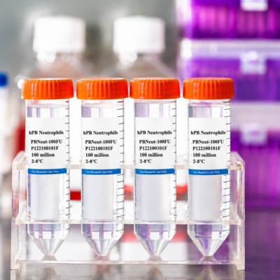 Human Peripheral Blood Neutrophils